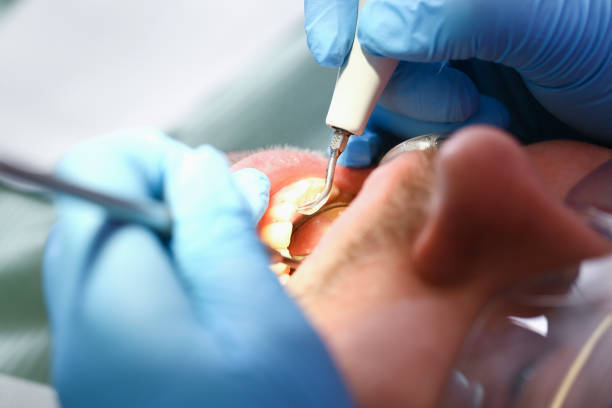 Best Walk-In Emergency Dental Services in Miamitown, OH
